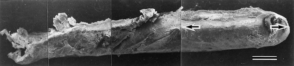 11 20 Tooth * Numbers denote tooth indices in the ADA system. GP gutta-percha point. FIG. 2. SEM image of gutta-percha specimen (sample 1).