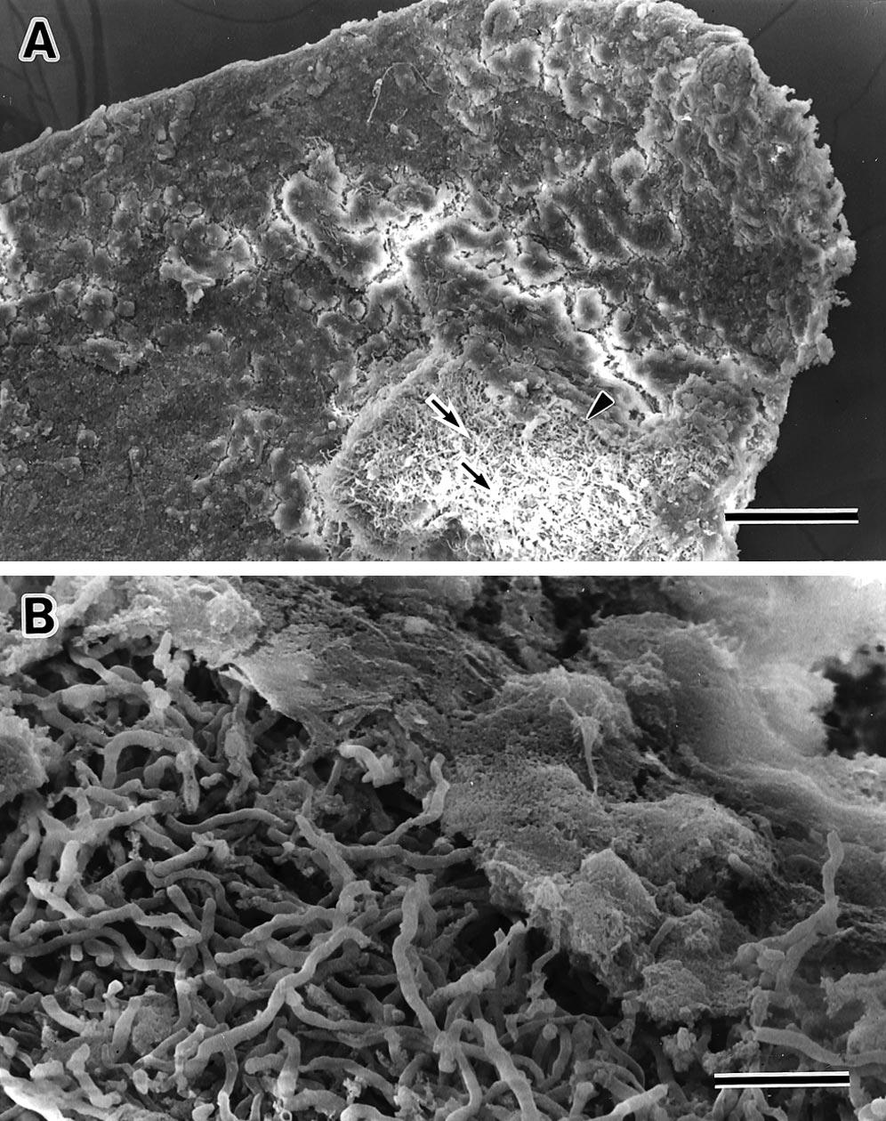 Vol. 28, No. 10, October 2002 Extraradicular Bacterial Biofilm 681 FIG. 3. SEM image of extruded gutta-percha. (A) Bacterial cells aggregate without a covering of a glycocalyx-like structure (arrows).
