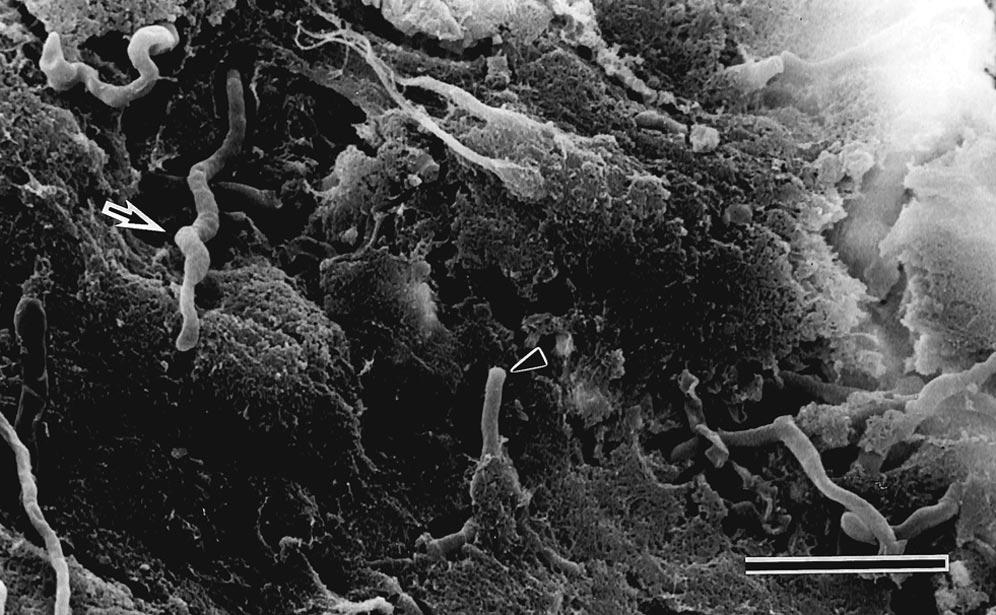 Glycocalyx structure is present in the upper right area but not in lower left area. Filamentous or spirochete-shaped bacteria are observed in lower left (original magnification 3500; bar 5 m). FIG. 4.