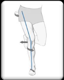 Proximal factors Recently, it was reported that functional mal-alignment does not arise in the knee joint but rather by