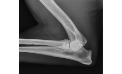 Elbow Dysplasia The Elbow The elbow is a hinge-type joint formed by the humerus, radius and ulna.