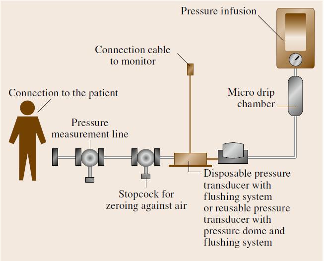 Invasive Pressure Measurement in High- Pressure System Continuous
