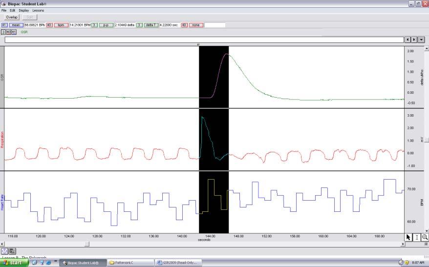 6. MEASURING GSR & HEART RATE: Also for the first stimulus, using the I- Bean cursor, select the data from the marker indicating stimulus 1 past the top of the GSR response to the stimulus (I would