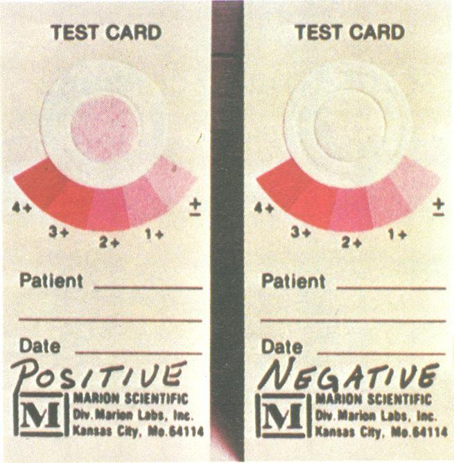 698 PEZZLO ET AL. J. CL-IN. MICROBIOL. TEST CARD 4 ;.+ 3' Patient Date 2 + VC NI MARaIO /%Z 7 SCIENTIFIC abs {e I_ Kins8 Cit. M0 6414 1 11v oft Ulwo lot + TEST CARD P.atien-r'. + 2.. 3+ 2; i + Patient.