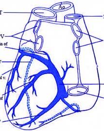 Mean arterial pressure 2. Complex coronary lesion 3.