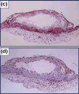 atherosclerosis of leptin-deficient mice 4 weeks 16 weeks ob/ob; ob/ob; Exogenous leptin increased