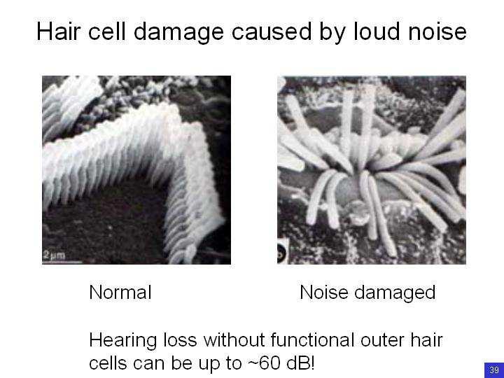 Slide 18 Contraction of the outer hair cells increases sensitivity of hearing. When they are stimulated, they contract.