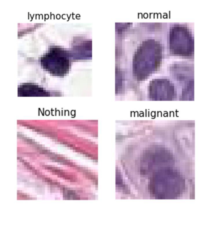 Human Classification Lymphocytes are small, dark round nucleus Normal epithelial cells are lighter and slightly bigger than
