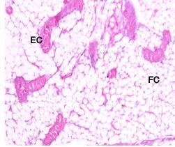Fig.6: Light micrograph of a section in the mammary gland epithelia of the rat treated with only turmeric