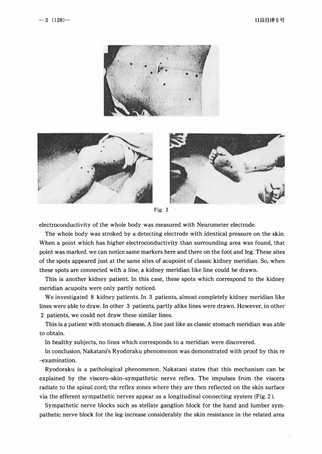 Fig. 1 electroconductivity of the whole body was measured with Neurometer electrode. The whole body was stroked by a detecting electrode with identical pressure on the skin.