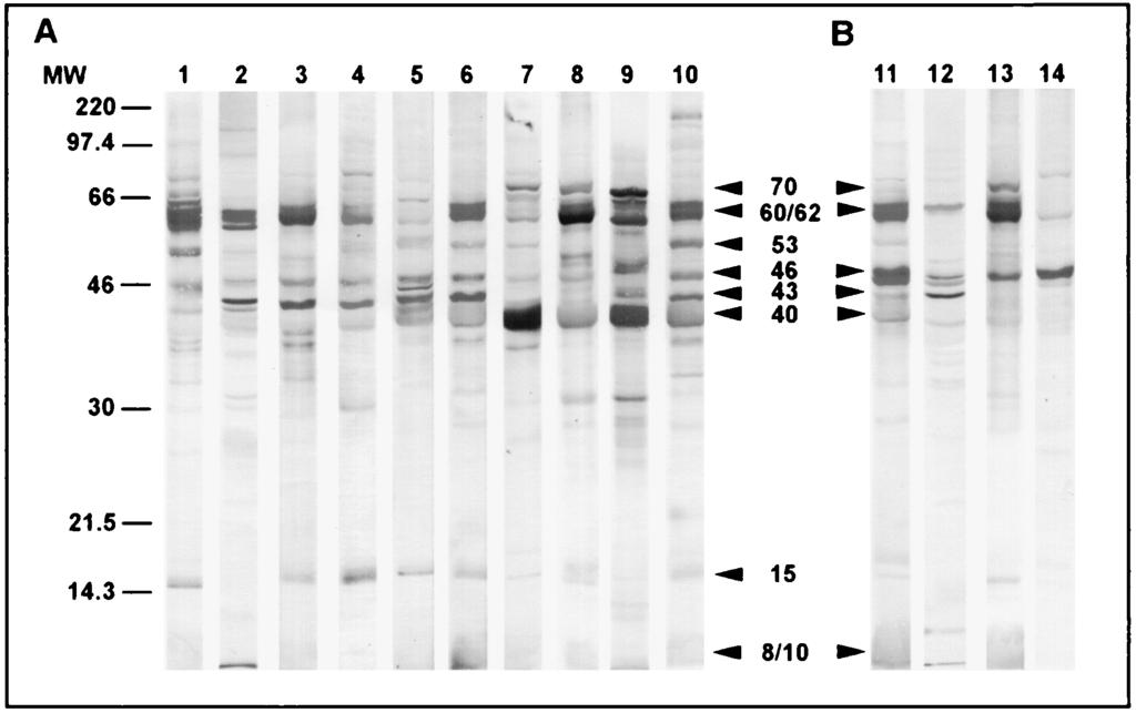 VOL. 6, 1999 ANALYSIS OF IMMUNE RESPONSE TO CHLAMYDIA PNEUMONIAE 821 FIG. 1. IgG immunoblots obtained with sera from patients with chlamydial infections diagnosed by culture and/or PCR and MIF serology.