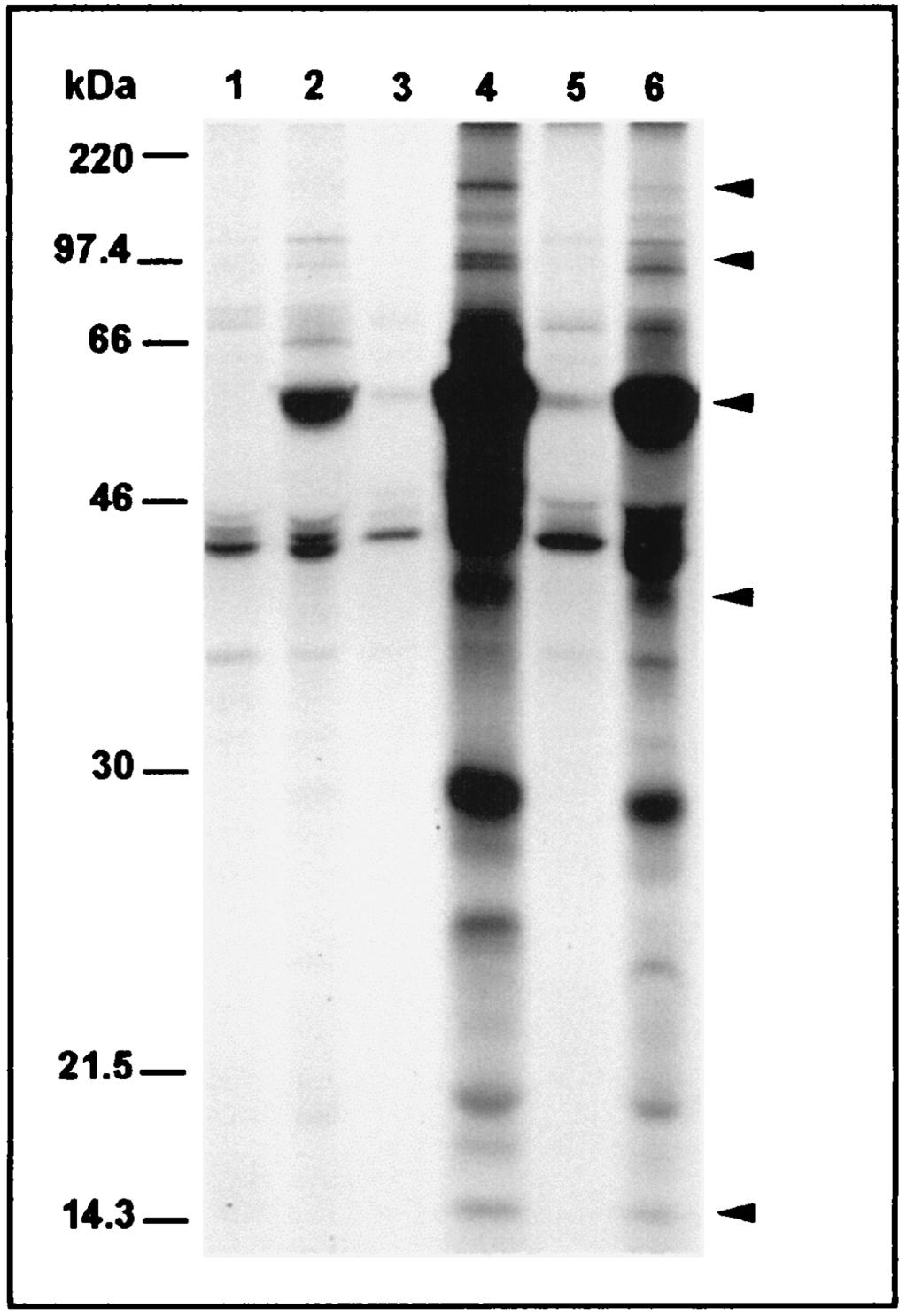VOL. 6, 1999 ANALYSIS OF IMMUNE RESPONSE TO CHLAMYDIA PNEUMONIAE 823 FIG. 4. Autoradiographs of SDS-PAGE gels showing a sequential immunoprecipitation of C.