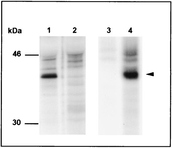 Immunoprecipitation was done with pooled serum from three experimentally infected mice.