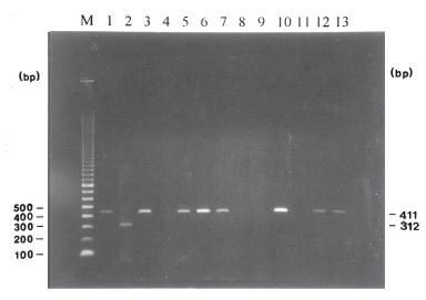 GENOTYPE IDENTIFICATION OF C. PARVUM IN FECAL SAMPLES Fig 2- DNA extracted from fecal samples from HIV-positive adults amplified using the 021F, CP-CR, and CP-HR diagnostic primers.