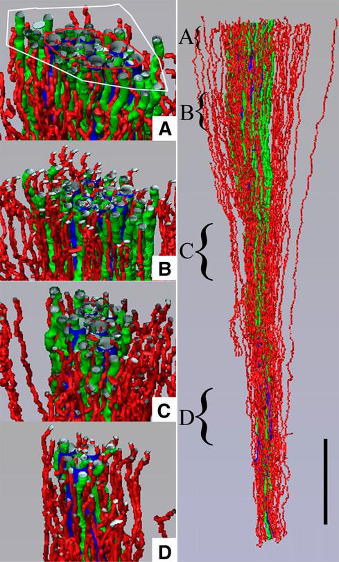 6 Clinial Journal of the Amerian Soiety of Nephrology Figure 6. Three-dimensional model illustrating staks of interstitial nodal spaes (white) surrounding a single CD.