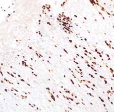 Immunohistochemical studies revealed high expression levels of napsin A in human lung and kidney but low expression in spleen.
