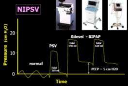 áp lực hỗ (PS = IPAP EPAP khi BN có lỗ lực thở vào Phù hợp sinh lý hơn Đạt thể tích khí