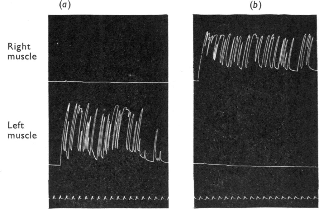NEUROMUSCULAR DRUGS ON THE SPINAL CORD 415 (a) (b) Right muscle Left muscle Fig. 4. Records of right (top trace) and left (middle trace) anterior tibialis muscles of a decerebrate cat.