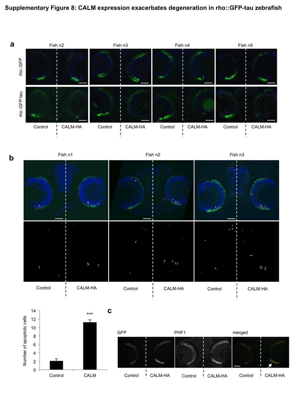 Supplementary Figure 8. CALM expression exacerbates degeneration in rho::gfp-tau zebrafish (a). Further examples of fish from the experiment described in Figure 9B are presented. Scale bar, 50 m. (b).
