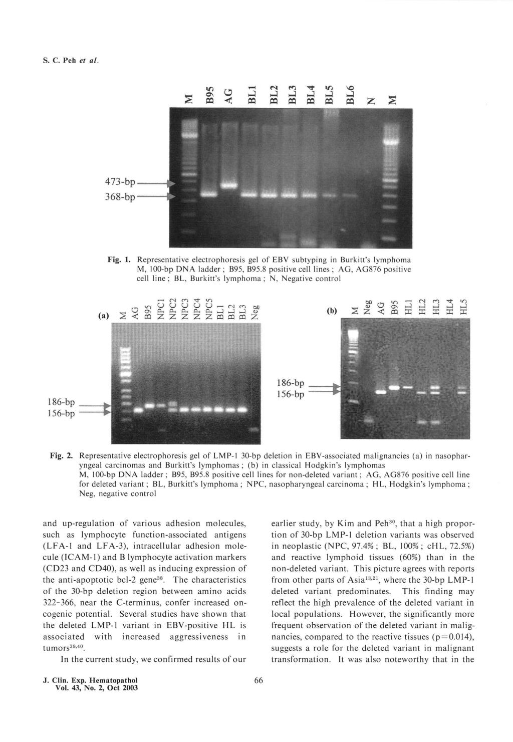 S. C. Peh et al. Fig. 1. Representative M, 100-bp cell line; electrophoresis DNA ladder; BL, Burkitt's gel of EBV B95, B95.