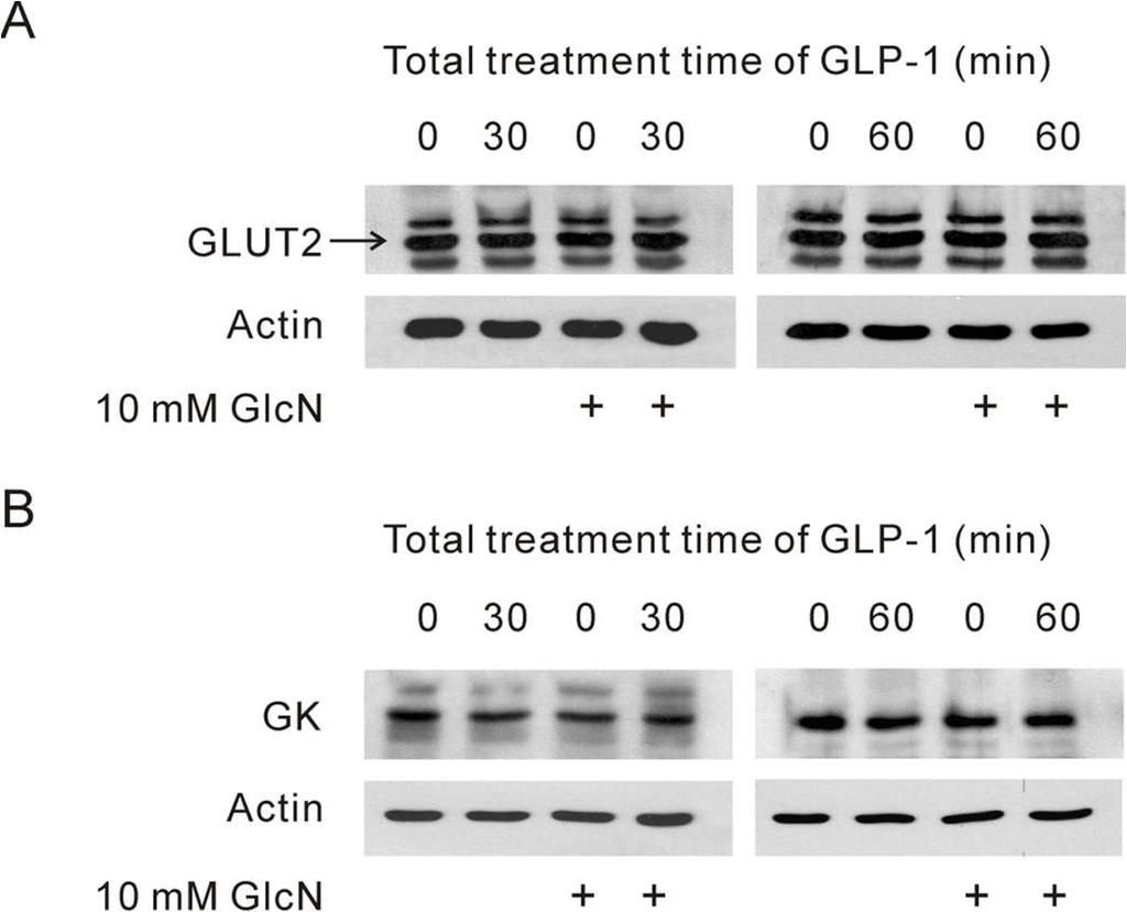 Effect of GLP-1 on