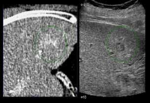 images, side-by-side with the live ultrasound image.