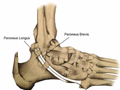 Peroneus brevis Tendon - follow the tendon from its insertion at the