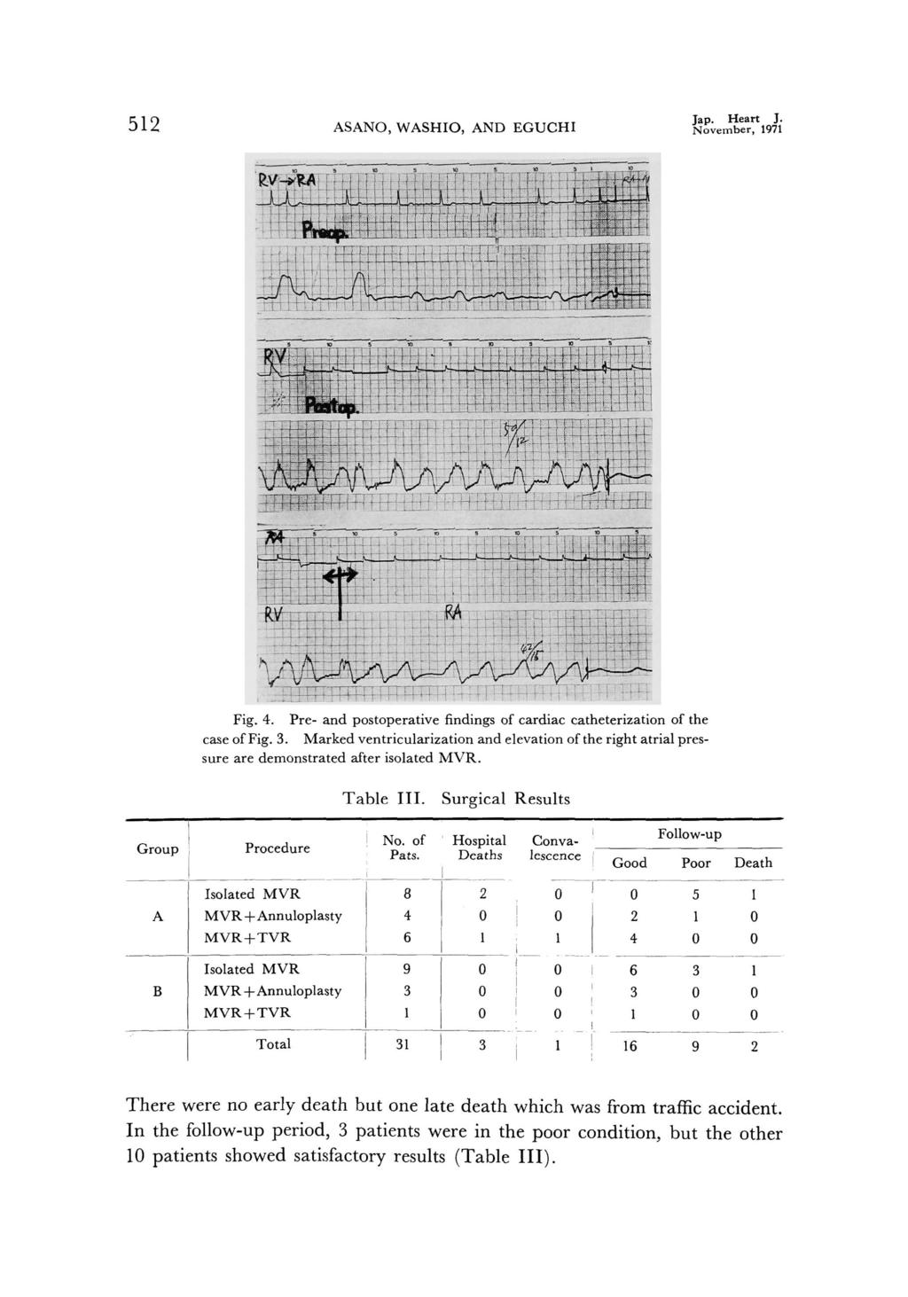 512 ASANO, WASHIO, AND EGUCHI Jap. Heart J. November, 1971 Fig.4. Pre- and postoperative findings of cardiac catheterization of the case of Fig.3.