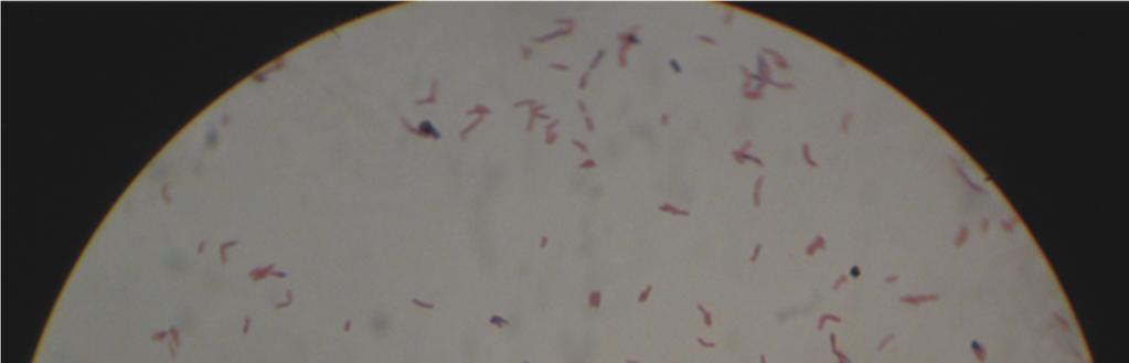 naključno izbranih kolonij bifidobakterij, ki smo jih predhodno osamili iz
