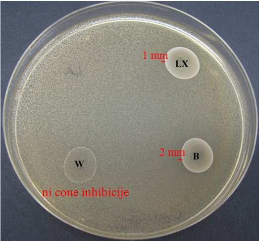 Pri ugotavljanju protimikrobne aktivnosti bifidobakterij proti indikatorskim bakterijam B. cereus, Staph. aureus IM 388 in Staph.