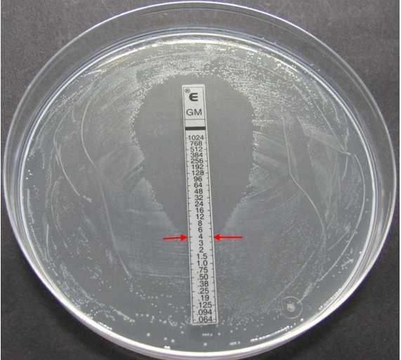 (a) (b) (c) (d) Slika 39: Testiranje občutljivosti bifidobakterij za antibiotike.