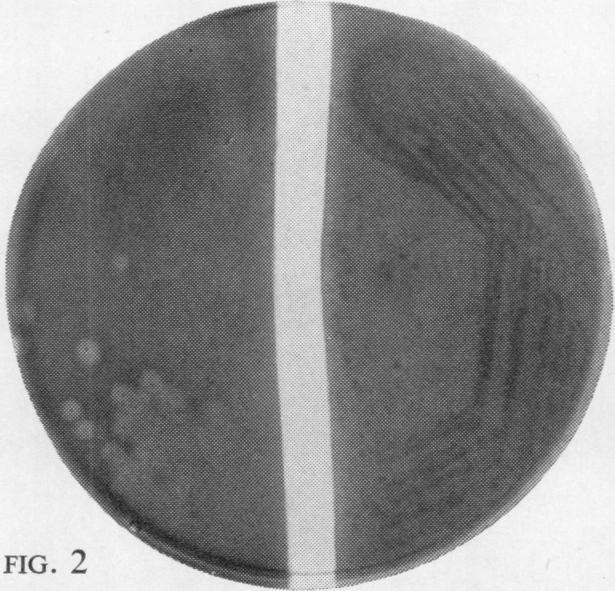 ) inoculated with (a) on left, Streptococcus pyogenes ahd Staphylococcus aureus and (b) on right, Streptococcus pyogenes with a mixture of Proteus mirabilis, Pseudomonas pyocyanea, Escherichia coli,