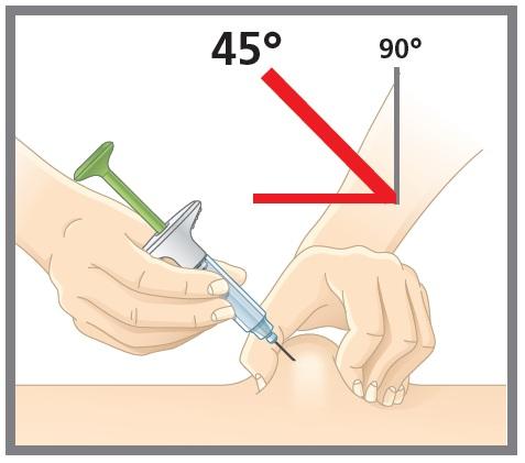 inject. 2c Insert the needle at a 45-degree angle.