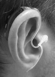 Wearing Your Hearing Aid 1. Hold the thin tube or earmold between your thumb and index finger.