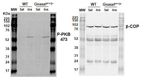 Supplementary Figure 1: PKB phosphorylation in mouse liver in response to insulin, and in