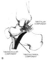 Tibionavicular ligament 2.