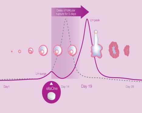 UPA - Mode of Action Primary mode of action is to inhibit or delay ovulation The probability of conception peaks just before ovulation ellaone s inhibitory effect on follicular
