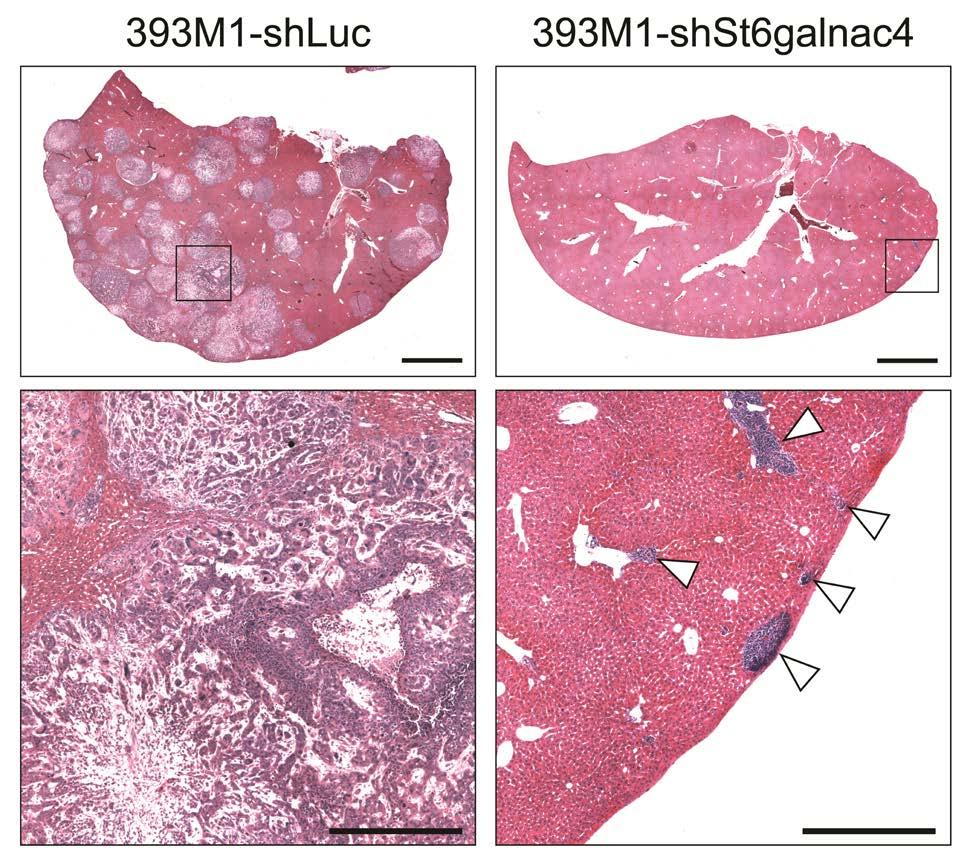 Supplementary Fig. 16. Knockdown of St6GalNAcIV reduces the formation of metastases in vivo.