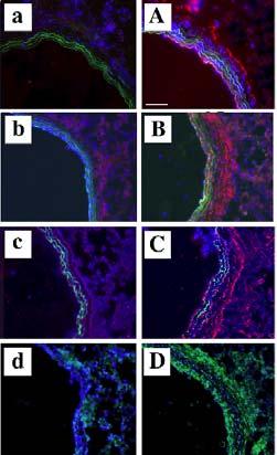 Hypoxia Induces PA-Specific mrna Upregulation (blue bars) of Adhesion Molecules, Growth and Differentiation Factors