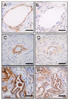 Accumulation of Inflammatory (CD68+) Cells is Associated with Fibroproliferative Vascular