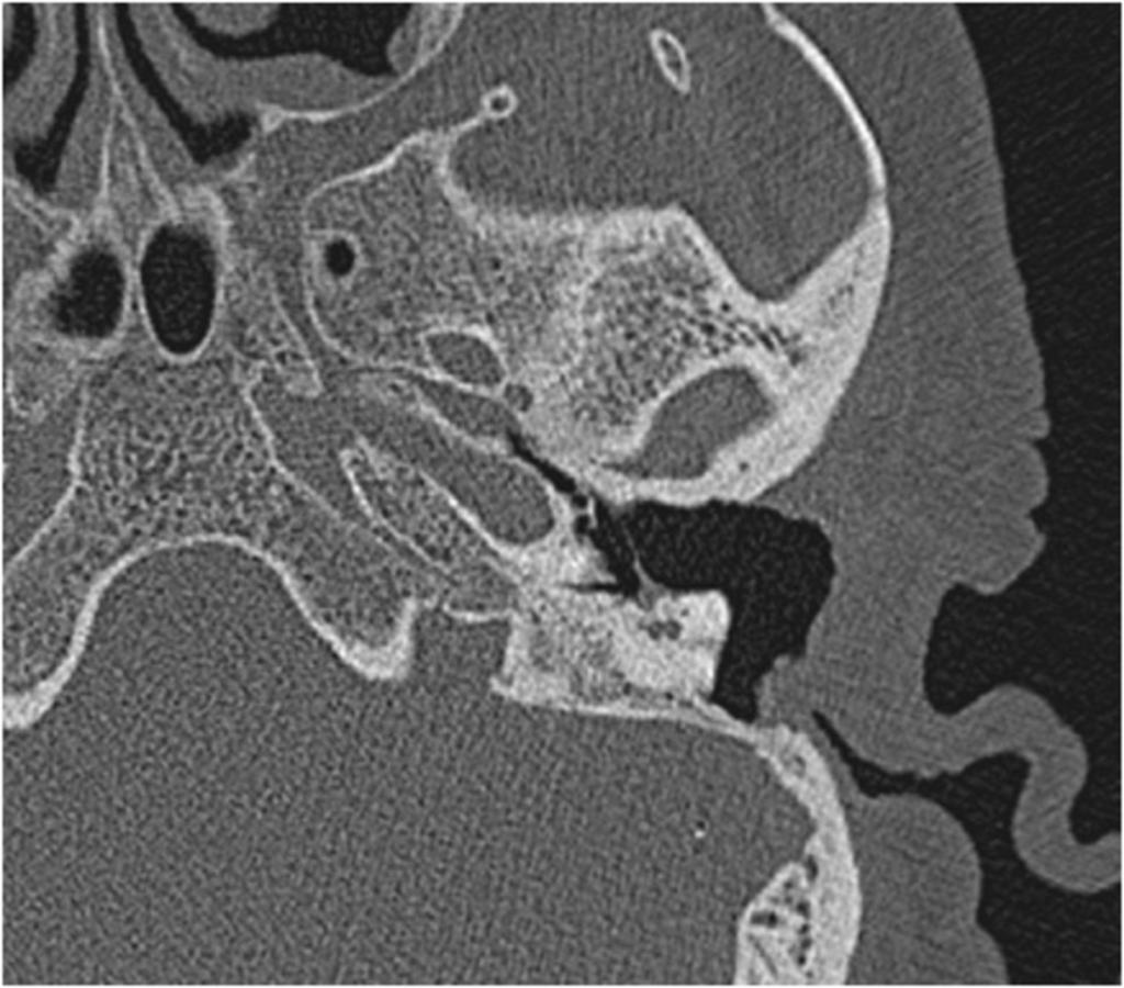 Fig. 11: CT axial image.