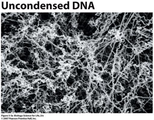 DNA needs to be condensed before it