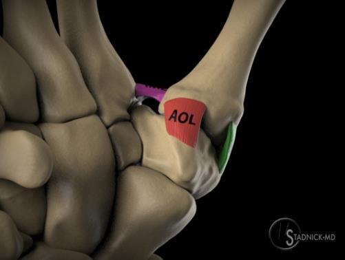 Anterior Oblique Ligament Bested evaluated on sagittal images http://radsource.