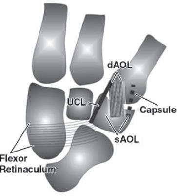 Ulnar collateral ligament (UCL) Extracapsular ligament Origin: distal and ulnar margin of trapezial ridge at flexor retinaculum insertion Insertion: