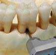 Our multi-rooted molars demonstrate the