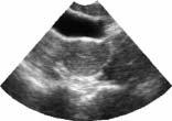 40 SECTION II Thoraco-Abdominal Protocols Male Bladder Transverse Axis Bladder Female Bladder Long Axis Bladder Vesico-uterine space Recto-uterine