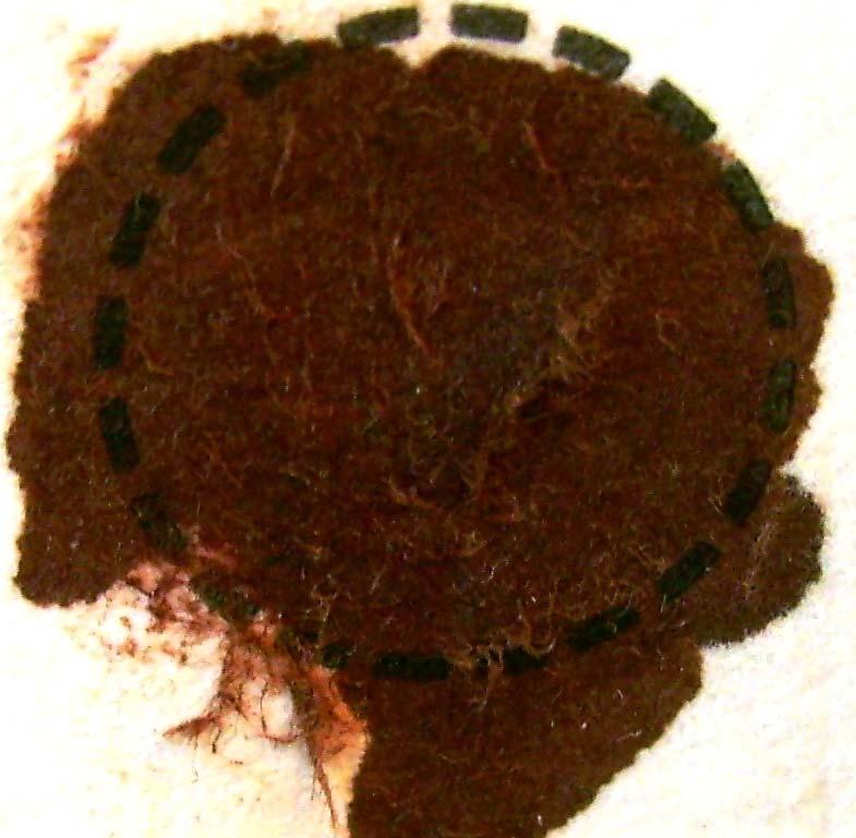 Because the surface of the filter paper on the blood collection card has been disturbed, we can no longer assume that