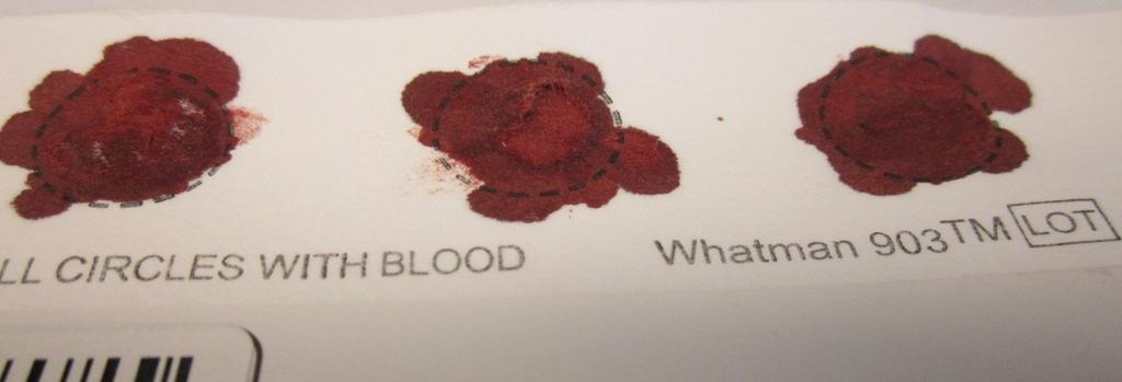 to the back side of the card, another blood drop may be applied to