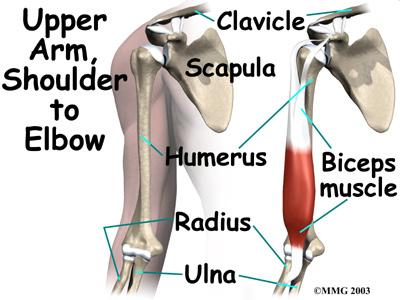 A torn biceps in younger athletes sometimes occurs during weightlifting or from actions that cause a sudden load on the arm, such as hard fall with the arm outstretched.