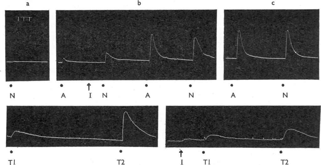 COCAINE AND ANTIDEPRESSANTS 345 b S 0 * * N A I N A N A N 0 a t t T TI T2 T2 Fig. 3. Spinal cats. Records of contractions of acutely decentralized membranes in two experiments.